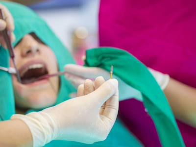 Zubni implantati - da li su bezbedni i koliko traju 